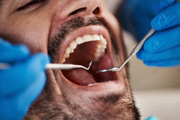 Best Emergency Treatment for Toothache in York, NE